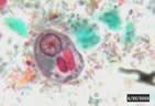 Amoeba